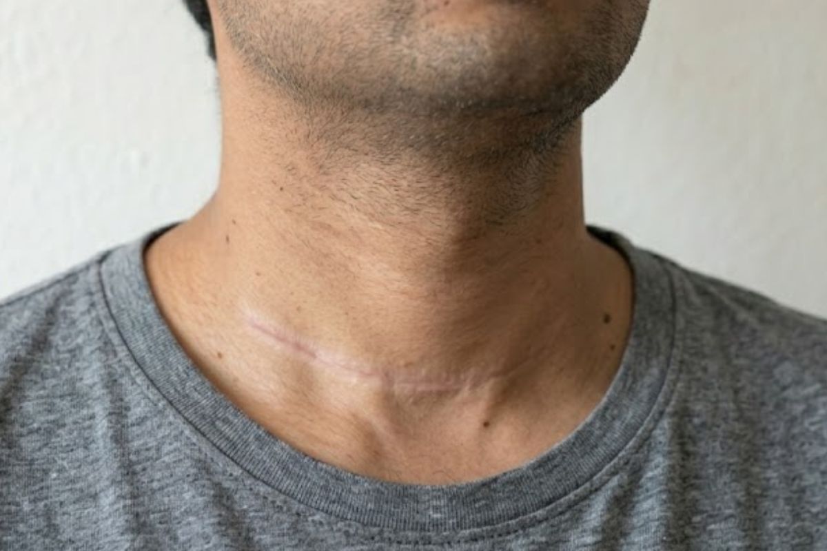 After treatment